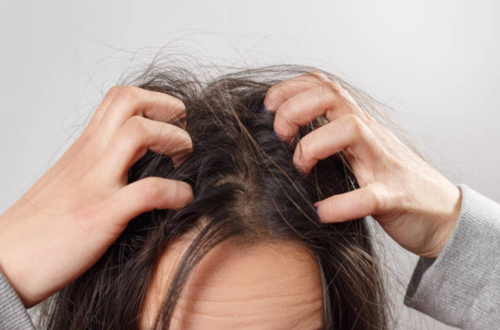 Scalp Irritation- Hair Smoothening Treatments