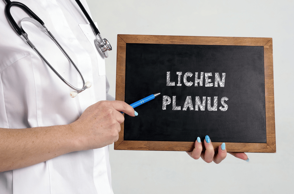 Lichen Planus